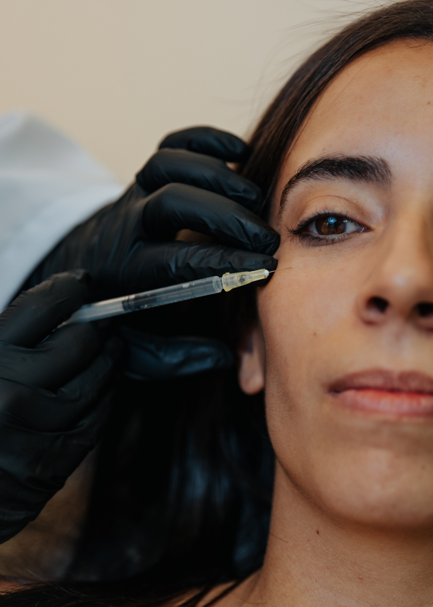 Mesoterpia periocular