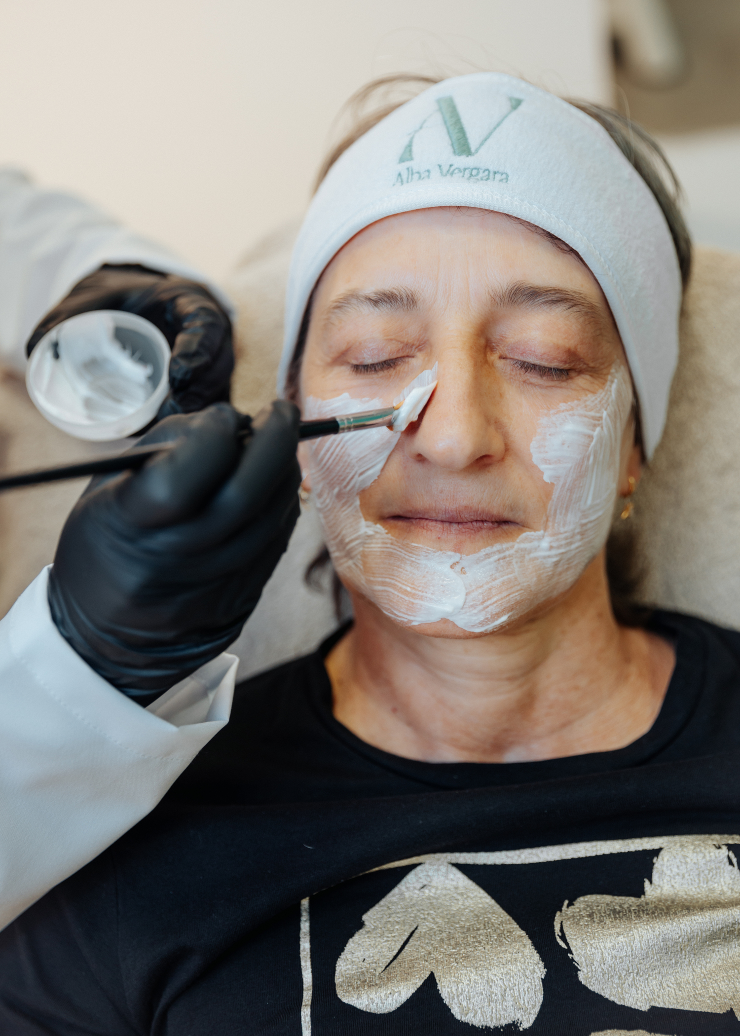 Peeling quimico zaragoza