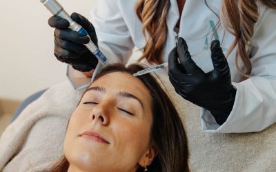 Dermapen para cicatrices de acné en piel sensible: guía completa y resultados
