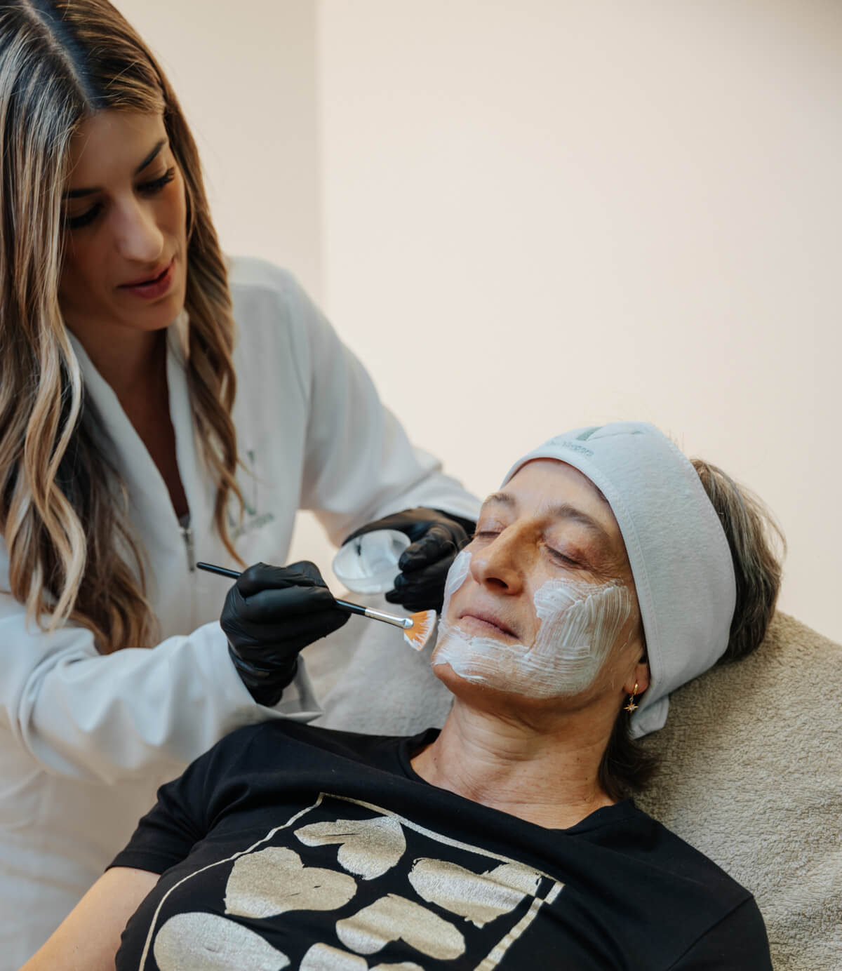 peeling quimico manchas piel morena